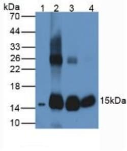 Invitrogen&trade;&nbsp;HBB Polyclonal Antibody