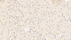 Invitrogen&trade;&nbsp;CaV1.2 Polyclonal Antibody