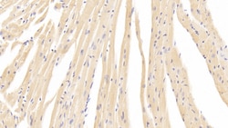 Invitrogen&trade;&nbsp;CaV1.2 Polyclonal Antibody