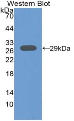 Invitrogen&trade;&nbsp;Tartrate Resistant Acid Phosphatase Polyclonal Antibody