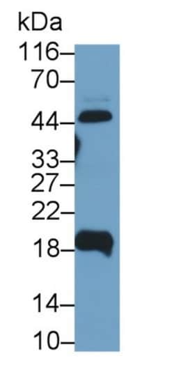 Invitrogen&trade;&nbsp;UPK2 Polyclonal Antibody