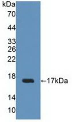 Invitrogen&trade;&nbsp;UPK2 Polyclonal Antibody