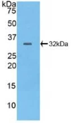 Invitrogen&trade;&nbsp;PTPRB Polyclonal Antibody
