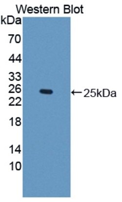 Invitrogen&trade;&nbsp;IFN epsilon Polyclonal Antibody