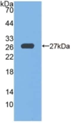 Invitrogen&trade;&nbsp;GPX6 Polyclonal Antibody