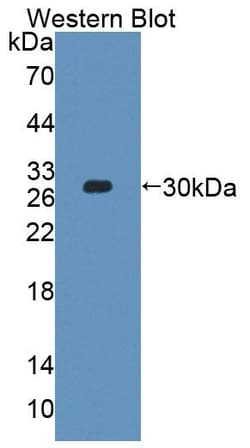Invitrogen&trade;&nbsp;PLCH2 Polyclonal Antibody