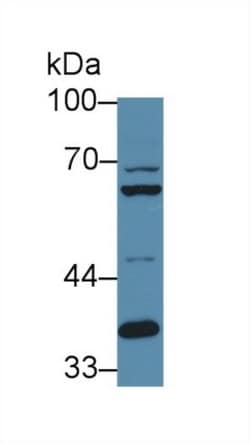 Invitrogen&trade;&nbsp;Furin Polyclonal Antibody