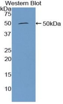 Invitrogen Furin Polyclonal Antibody 200 &mu;L; Unconjugated:Antibodies,