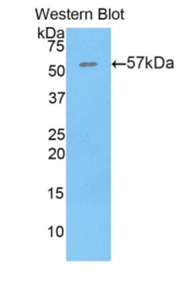 Invitrogen Thrombospondin 4 Polyclonal Antibody 200 &mu;L; Unconjugated:Antibodies,