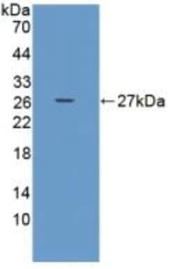 Invitrogen&trade;&nbsp;ADAMTS9 Polyclonal Antibody