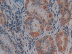 Invitrogen Thrombospondin 1 Polyclonal Antibody 200 &mu;L; Unconjugated:Antibodies,