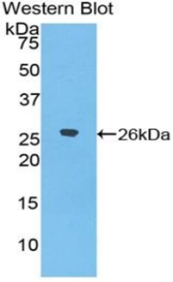 Invitrogen&trade;&nbsp;DSPG3 Polyclonal Antibody