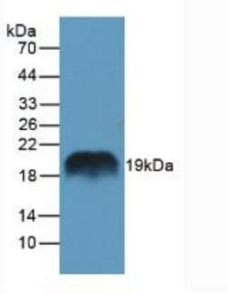Invitrogen&trade;&nbsp;REG1A Polyclonal Antibody