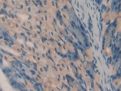 Invitrogen&trade;&nbsp;Oncomodulin Polyclonal Antibody