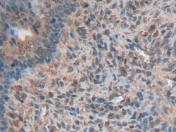 Invitrogen&trade;&nbsp;Kininogen Heavy Chain Polyclonal Antibody
