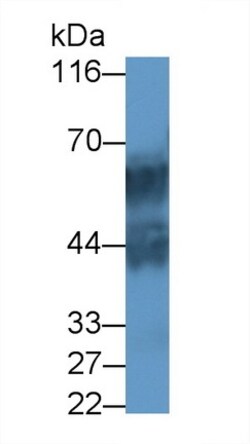 Invitrogen&trade;&nbsp;KRT71 Polyclonal Antibody
