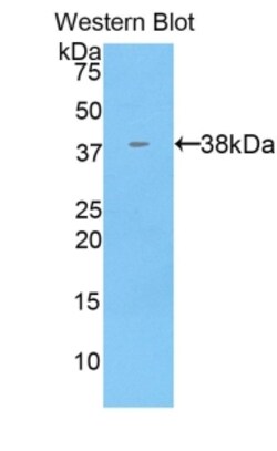 Invitrogen&trade;&nbsp;KRT71 Polyclonal Antibody