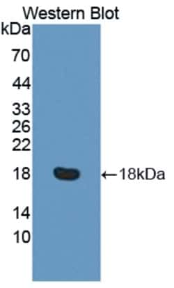 Invitrogen&trade;&nbsp;C13orf15 Polyclonal Antibody
