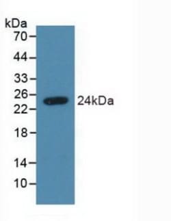 Invitrogen&trade;&nbsp;Syndecan 4 Polyclonal Antibody