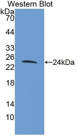 Invitrogen&trade;&nbsp;FAM20A Polyclonal Antibody