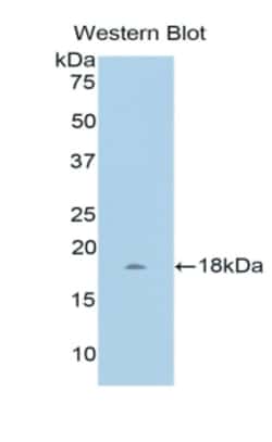 Invitrogen&trade;&nbsp;WISP1 Polyclonal Antibody