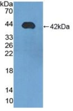 Invitrogen&trade;&nbsp;SCGB1D2 Polyclonal Antibody