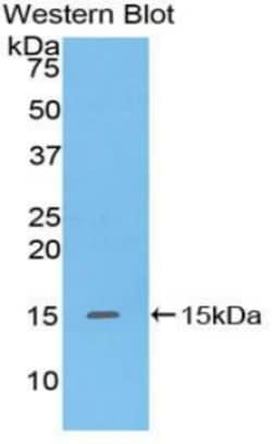 Invitrogen&trade;&nbsp;Defensin 5 Polyclonal Antibody