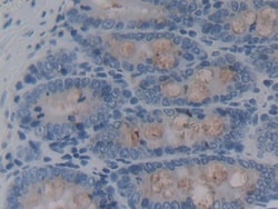 Invitrogen&trade;&nbsp;REG3B Polyclonal Antibody