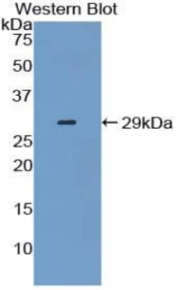 Invitrogen&trade;&nbsp;14-3-3 sigma Polyclonal Antibody