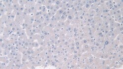 Invitrogen PANK4 Polyclonal Antibody 200 &mu;L; Unconjugated:Antibodies,