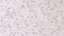 Invitrogen PANK4 Polyclonal Antibody 200 &mu;L; Unconjugated:Antibodies,