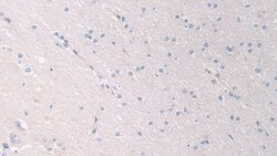 Invitrogen PANK4 Polyclonal Antibody 200 &mu;L; Unconjugated:Antibodies,