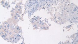 Invitrogen PANK4 Polyclonal Antibody 200 &mu;L; Unconjugated:Antibodies,