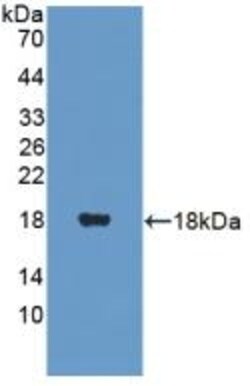 Invitrogen PANK4 Polyclonal Antibody 200 &mu;L; Unconjugated:Antibodies,