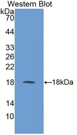 Invitrogen UBC9 Polyclonal Antibody 200 &mu;L; Unconjugated:Antibodies,