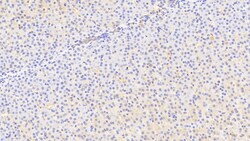 Invitrogen SLC25A37 Polyclonal Antibody 200 &mu;L; Unconjugated:Antibodies,