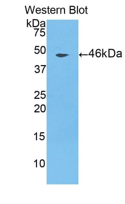 Invitrogen&trade;&nbsp;Cathepsin L Polyclonal Antibody