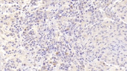 Invitrogen BAFF Receptor (CD268) Polyclonal Antibody 200 &mu;L; Unconjugated:Antibodies,