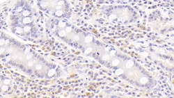 Invitrogen&trade;&nbsp;BAFF Receptor (CD268) Polyclonal Antibody