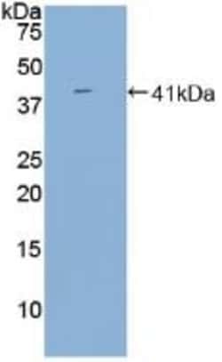Invitrogen BAFF Receptor (CD268) Polyclonal Antibody 200 &mu;L; Unconjugated:Antibodies,