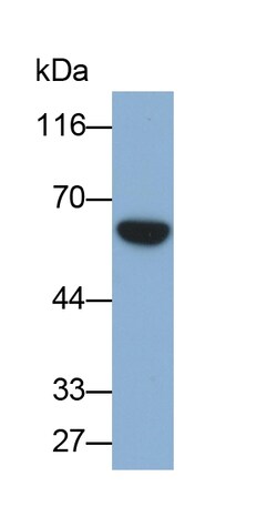 Invitrogen&trade;&nbsp;Asparagine Synthetase Polyclonal Antibody