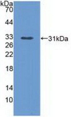 Invitrogen PLCE1 Polyclonal Antibody 200 &mu;L; Unconjugated:Antibodies,