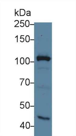 Invitrogen&trade;&nbsp;MYO1G Polyclonal Antibody