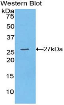 Invitrogen&trade;&nbsp;WISP2 Polyclonal Antibody