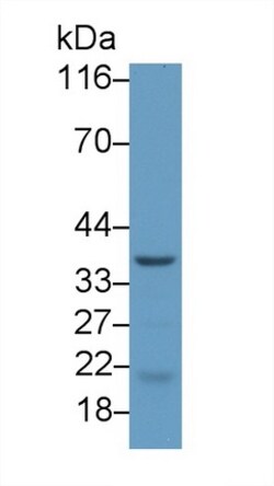 Invitrogen&trade;&nbsp;CHRNE Polyclonal Antibody