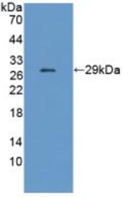 Invitrogen&trade;&nbsp;CHRNE Polyclonal Antibody