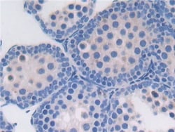 Invitrogen™ Protein Z Polyclonal Antibody