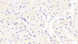 Invitrogen FLRT2 Polyclonal Antibody 200 &mu;L | Buy Online | Invitrogen&trade; | Fisher Scientific