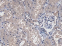 Invitrogen&trade;&nbsp;CBY1 Polyclonal Antibody