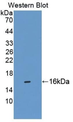 Invitrogen&trade;&nbsp;CBY1 Polyclonal Antibody